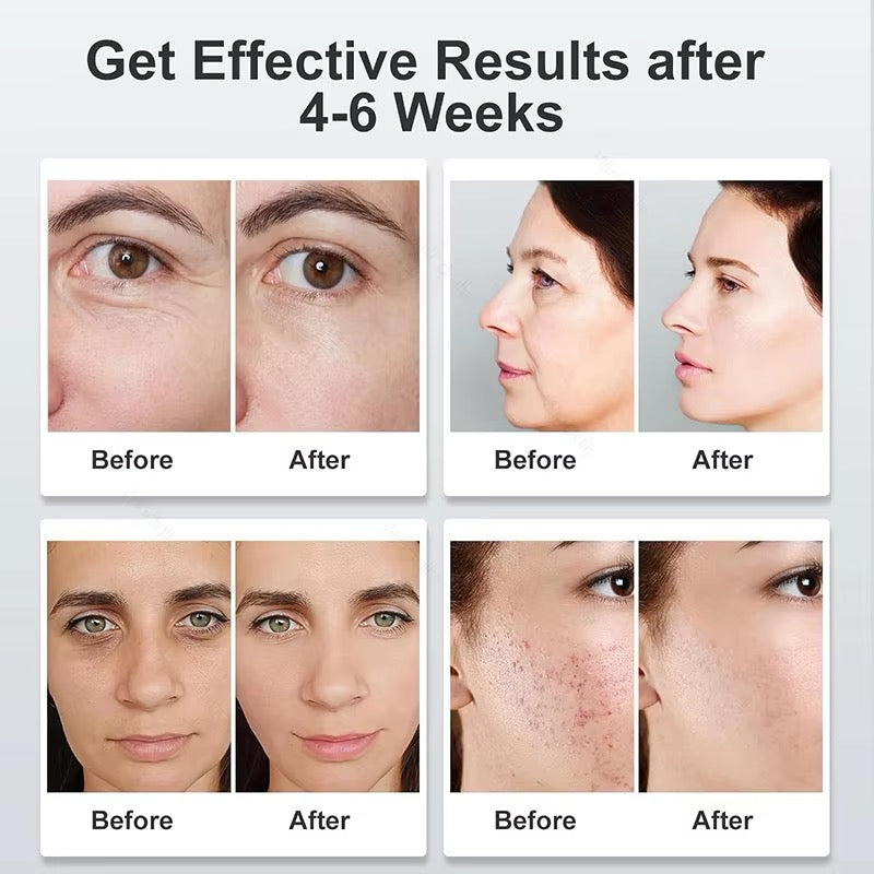 LumiGlow™ LED Light Therapy Mask – Radiant Skin, Effortlessly